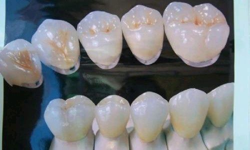 口腔修复学课程封面